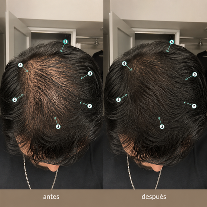 VIREON® Serum Avanzado para el Crecimiento de Barba y Cabello