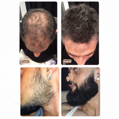 VIREON® Serum Avanzado para el Crecimiento de Barba y Cabello