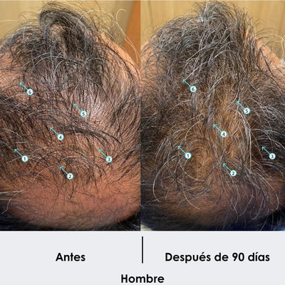 VIREON® Serum Avanzado para el Crecimiento de Barba y Cabello